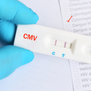 CMV Infektion