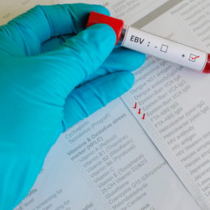Epstein-Barr-Virus Epstein-Barr-Virus